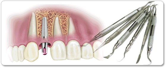 Oral Surgery Los Angeles